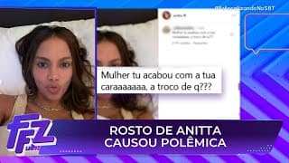 Anitta responde críticas após plástica no rosto | Fofocalizando 11/07/25