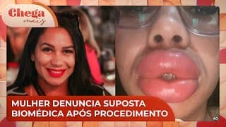 Vítima conta que suposta biomédica aplicou PMMA em preenchimento labial | Chega Mais (19/11/24)