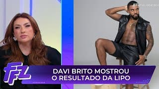 Davi Brito mostra resultado de lipo HD e divide opiniões | Fofocalizando 19/05/25