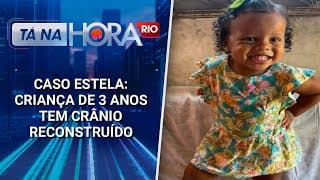 Caso Estela: criança de 3 anos tem crânio reconstruído