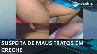 Mãe denúncia creche particular na após filho chegar em casa machucado | SBT Brasília 2ª edição