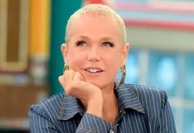 Xuxa Meghel muda de visual ao fazer transplante capilar