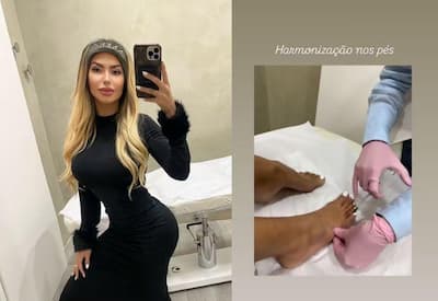 Influenciadora faz harmonização nos pés após gastar R$ 3 mil em sapato