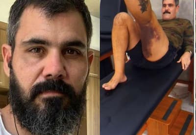 Juliano Cazarré faz fisioterapia após duas cirurgias no joelho: "Doloroso"