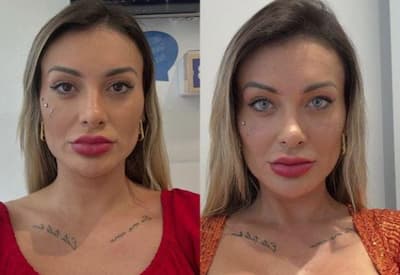 Andressa Urach se arrepende de procedimento que mudou cor dos olhos