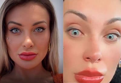 Andressa Urach revela medo de perder a visão após mudar a cor dos olhos
