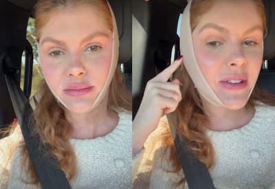 Bárbara Evans surge com faixa no rosto e brinca sobre estética: "Eu sou um meme"