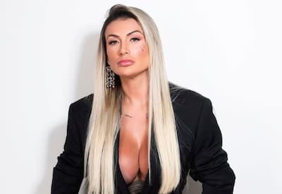 Andressa Urach aparece com o rosto cheio de sangue e divide opiniões