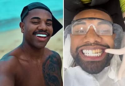 Davi Brito troca lente nos dentes após se arrepender de resultado: "Muito grande"