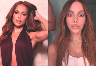Anitta se pronuncia após comentários sobre procedimentos estéticos: "Tensão no ar"