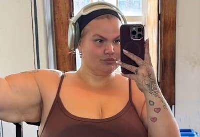 Thais Carla revela queda de cabelo após cirurgia bariátrica