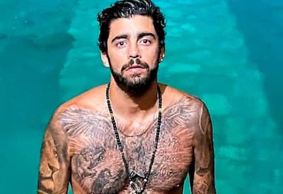 Pedro Scooby surge com o rosto inchado e explica motivo