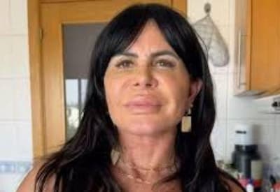 Gretchen realiza novas cirurgias estéticas no rosto e explica os motivos