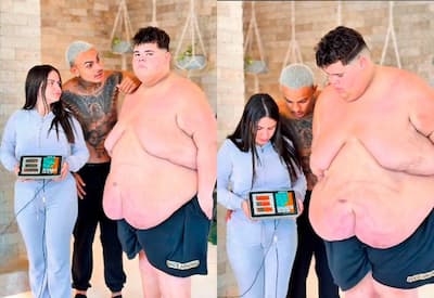 Gordão da XJ perde 115 kg e conquista meta para realizar bariátrica
