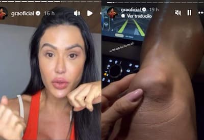 Gracyanne Barbosa mostra recuperação após cirurgia de joelho e agradece apoio de fãs