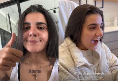 Yasmin Santos fica surpresa ao conferir resultado da rinoplastia: "Sou outra pessoa"