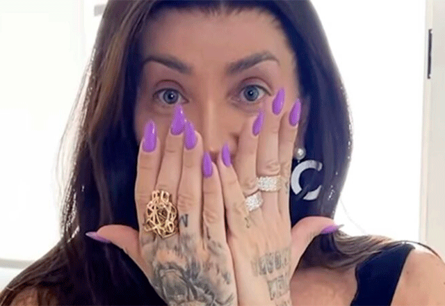 Maya Massafera revela resultado de novo rosto após cirurgia no maxilar