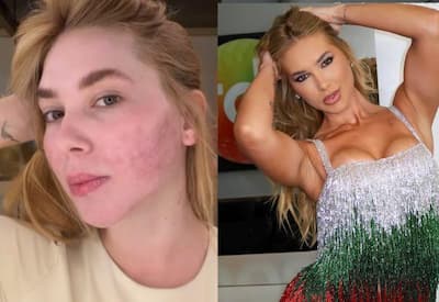 Virginia lamenta procedimento estético: "Tinha necessidade de inventar isso?"