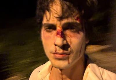 Fiuk surge com rosto machucado e preocupa seguidores na véspera de Natal