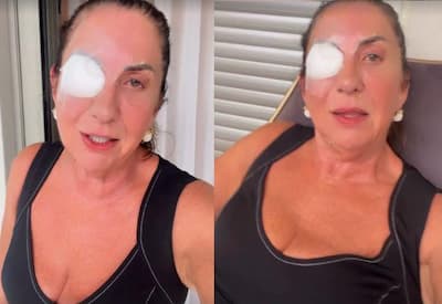 Mãe de Virginia, Margareth Serrão passa por cirurgia no olho e explica afastamento das redes