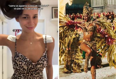 Alane Dias rebate polêmica nas redes após vídeo mostrando curativos