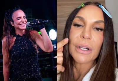 Ivete Sangalo mostra recuperação após cirurgia no rosto