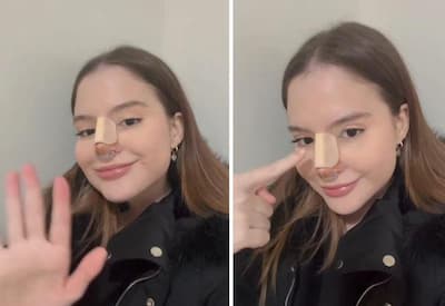 Sophia Valverde celebra resultado de cirurgia no nariz: "Ficou perfeito"