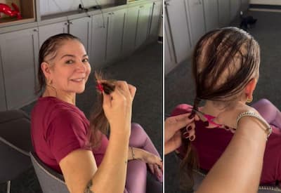 Mãe de Lucas Lucco fala sobre diagnóstico de alopecia areata; entenda