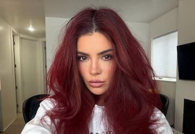 Gkay abre o jogo sobre "exageros" em procedimentos estéticos