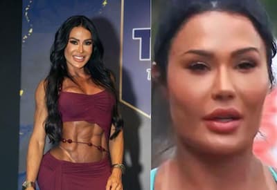 Gracyanne remove preenchimentos do rosto e revela mudança estética