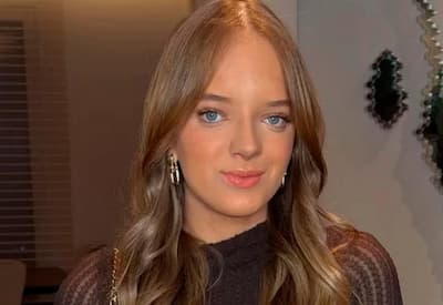 Rafa Justus faz nova rinoplastia e médico mostra resultado