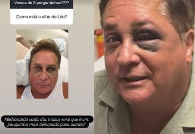 Leonardo apresenta melhora após acidente durante pescaria