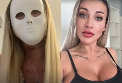 Andressa Urach revela nova cirurgia no rosto, detalha mudanças e agita a web