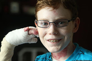 jonathan pitre, garoto borboleta