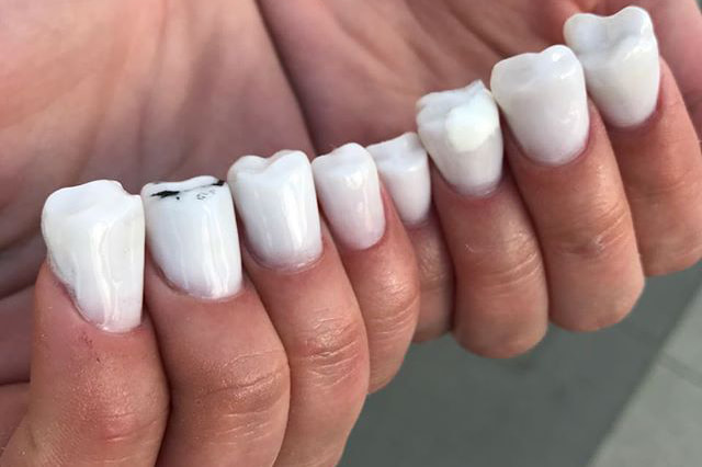 montagem unhas e sorriso com dentes à mostra 