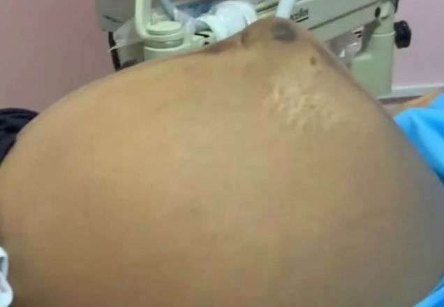 Criança se mexe em barriga de mãe e vídeo viraliza