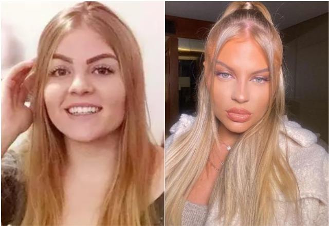 Antes e depois da cantora Luísa Sonza