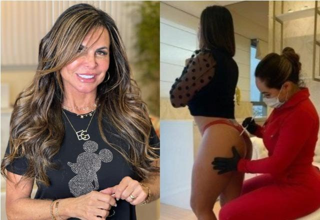 Gretchen mostra tratamento no bumbum