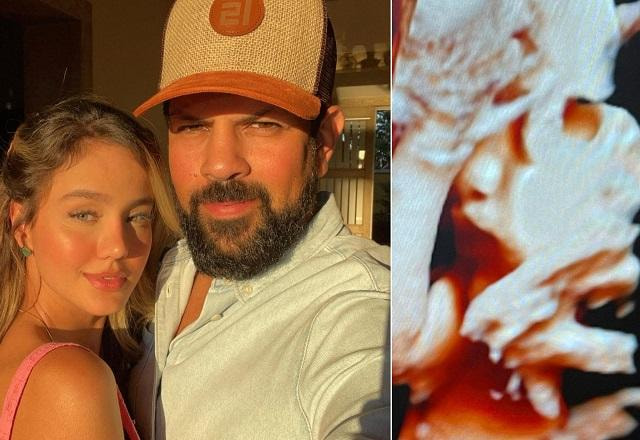Biah Rodrigues com Sorocaba e uma imagem do ultrassom mostrando o rosto da filha do casal