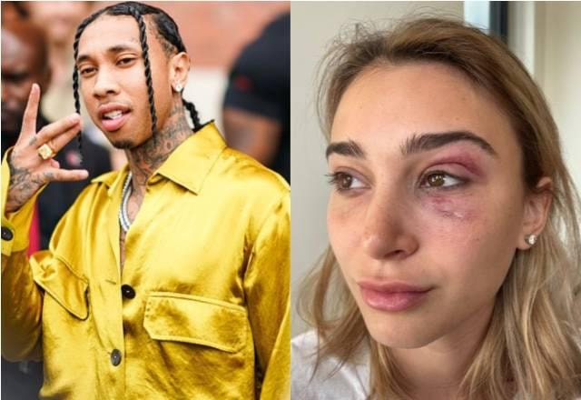 Rapper Tyga à esquerda; Camaryn Swanson com o olho roxo à direita