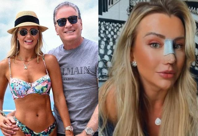 Ana Paula Siebert e Roberto Justus à esquerda; Ana Paula Siebert com curativo à esquerda