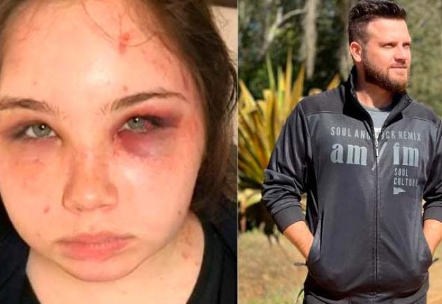 Montagem com os rostos de Kauane Cellarius, machucada, e Fernando Cellarius