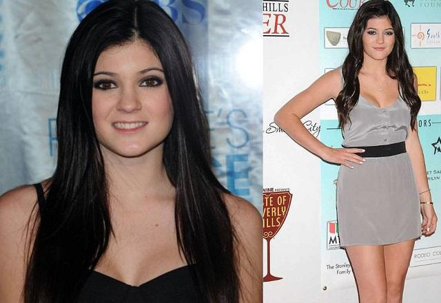 Kylie Jenner antes