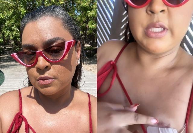 Prints dos Stories do Instagram de Preta Gil mostrando cicatriz e adesivo no peito