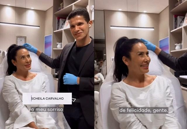 Montagem com fotos de Sheila Carvalho, vestida de branco, em uma cadeira de consultório, sorrindo por fazer procedimento para retirada de ácido hialurônico