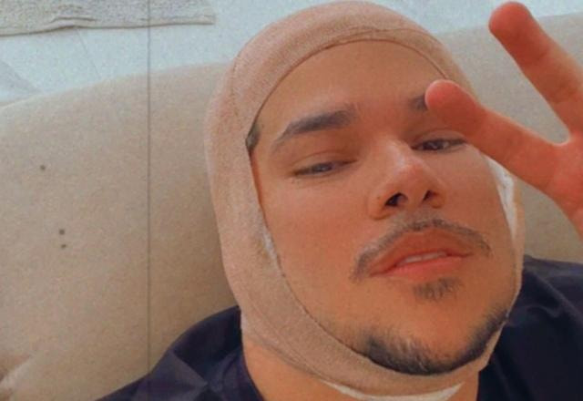 Imagem de Dj Buarque com a cabeça enfaixada por motivo de ter perdido parte da orelha em um acidente