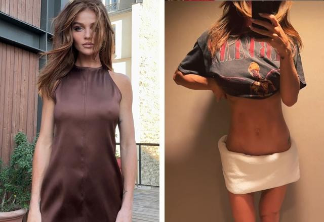 Montagem com fotos de Cintia Dicker, uma com um vestido marrom e outra mostrando a barriga chapada, resultado de um procedimento estético