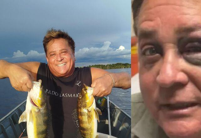 Leonardo sofre acidente em pescaria e preocupa fãs ao aparecer machucado