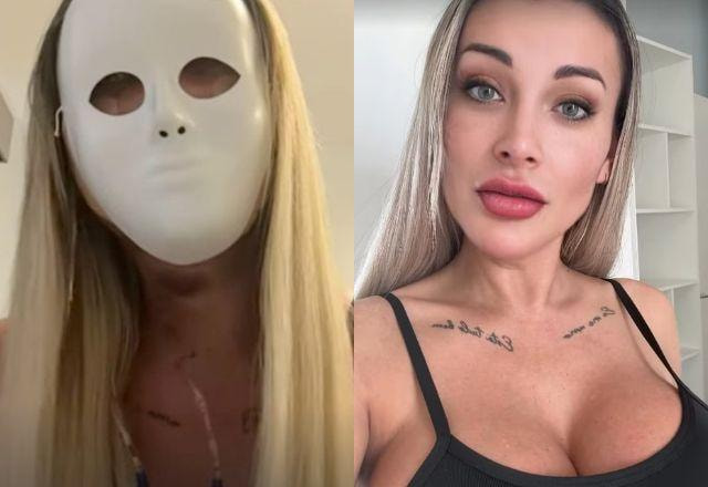 Andressa Urach revela nova cirurgia no rosto, detalha mudanças e agita a web