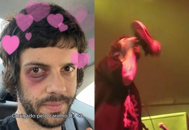 Na foto temos imagens de durante e pós show do Diogo Defante, humorista que se machucou após sapatada de fã